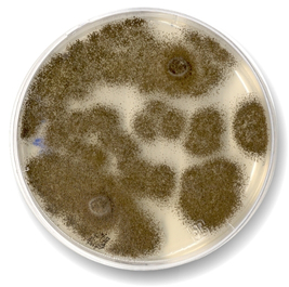 Aspergillus en FVH